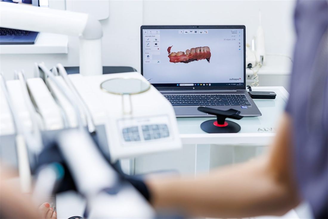 3D-Scan eines Kiefers am Laptop