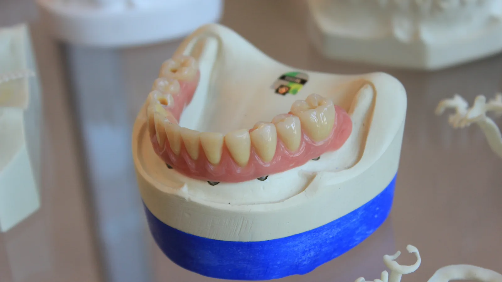 Zahnprothese auf einem Ablagegestell im Dentallabor