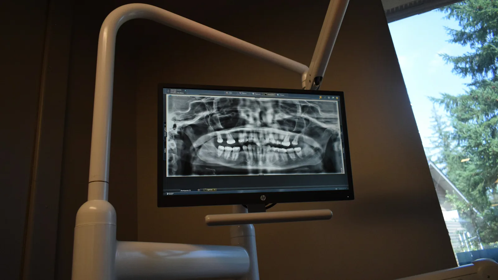 Panorama-Röntgenaufnahme des Kiefers auf einem Klinikmonitor