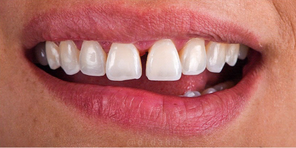 https://dentalreise.ch/wp-content/uploads/2022/09/cosmetic-dentist-los-angeles-131.jpg