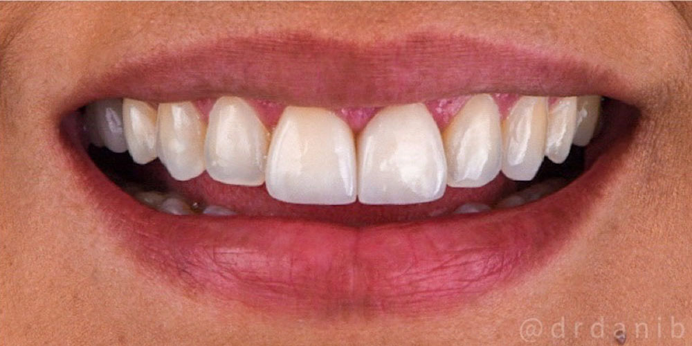 https://dentalreise.ch/wp-content/uploads/2022/09/cosmetic-dentist-los-angeles-13133.jpg