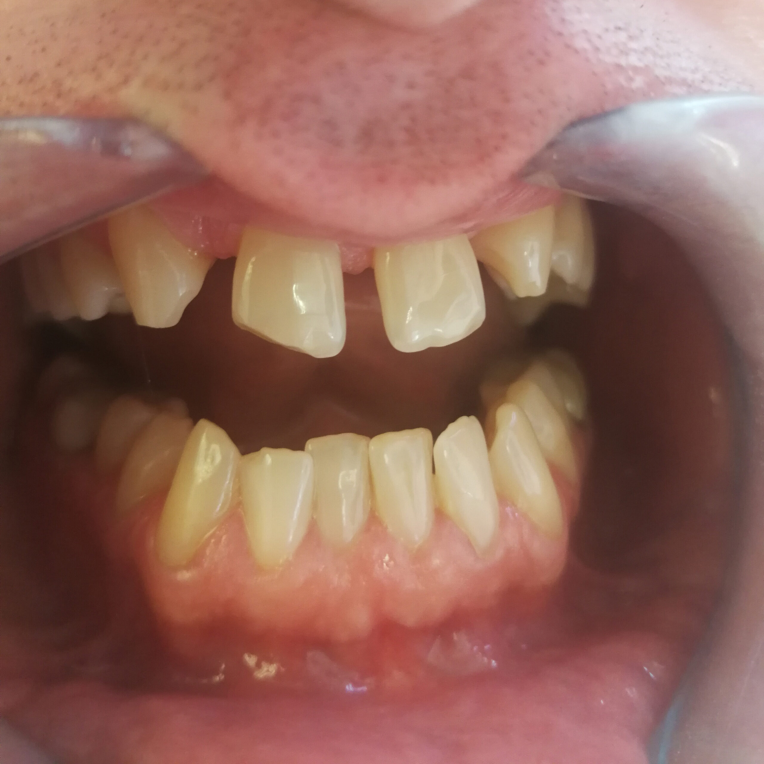 https://dentalreise.ch/wp-content/uploads/2022/10/A2-scaled.jpg