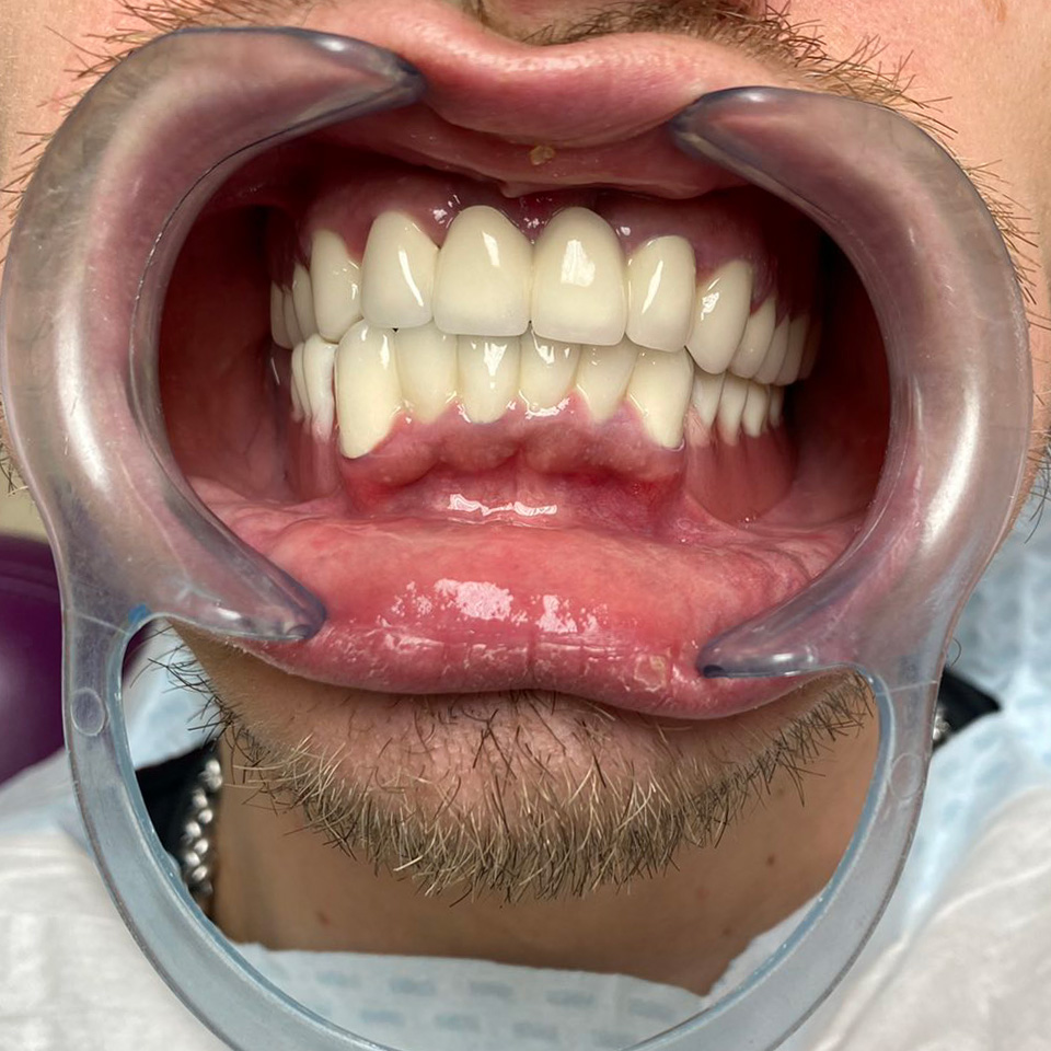 https://dentalreise.ch/wp-content/uploads/2022/10/Oli2.jpg
